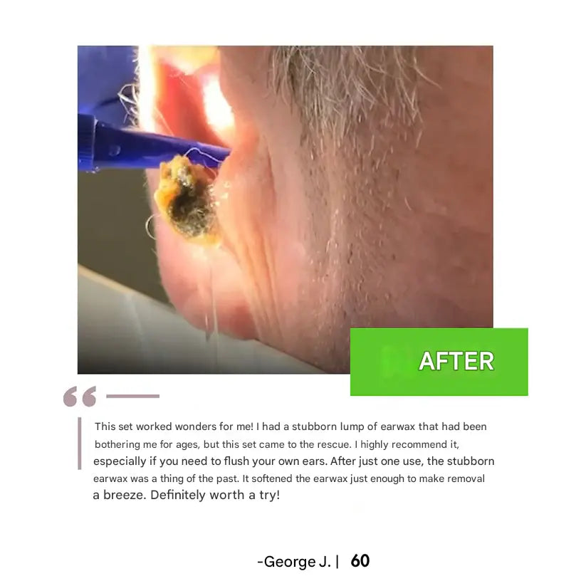 Drexa™ PRO Ear Cleaner 2.0 Drexa
