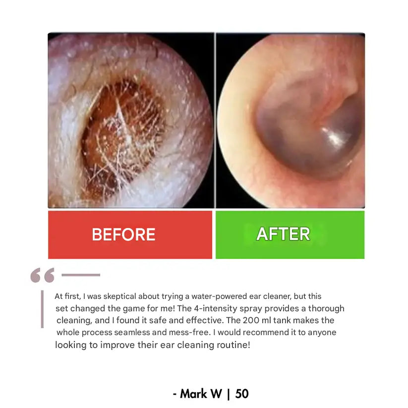 Drexa™ PRO Ear Cleaner 2.0 Drexa