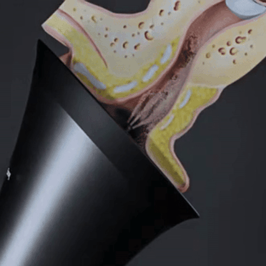 Drexa™ PRO Ear Cleaner 2.0 Drexa